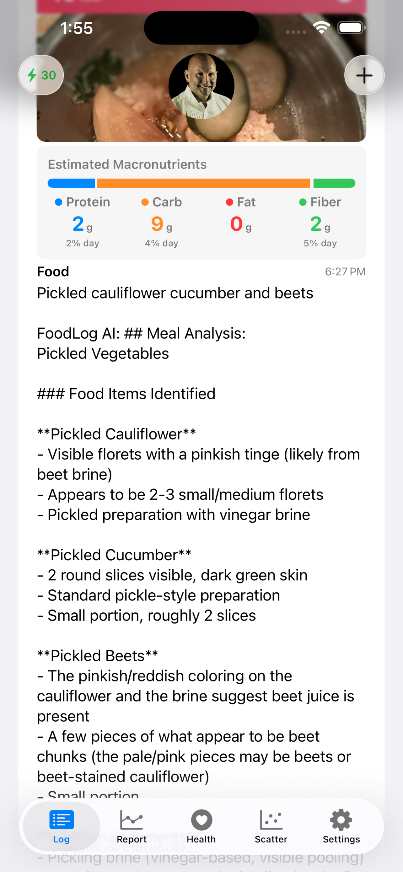 AI food analysis details from meal photo and notes